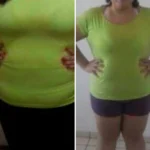 Julia Mendes, 34 anos: Além de emagrecer, percebi uma melhora significativa nas minhas estrias. Vitalis Forma é maravilhoso!