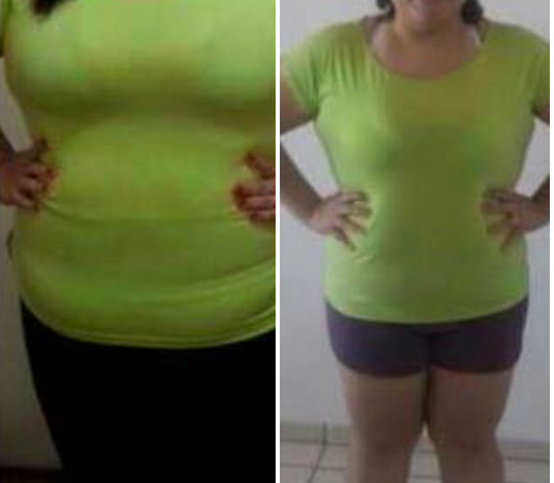 Julia Mendes, 34 anos: Além de emagrecer, percebi uma melhora significativa nas minhas estrias. Vitalis Forma é maravilhoso!